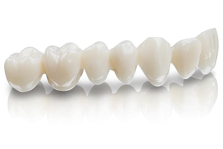 Resina para impresora 3D Bego VarseoSmile TriniQ C2, 0,25 kg - Imagen 3