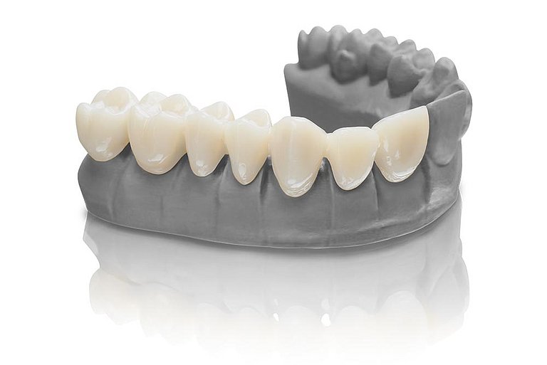 Resina para impresora 3D Bego VarseoSmile TriniQ C2, 0,25 kg - Imagen 5